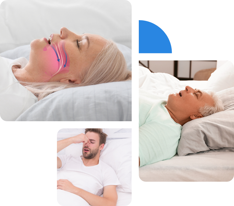 Sleep Apnea Treatment Lancashire